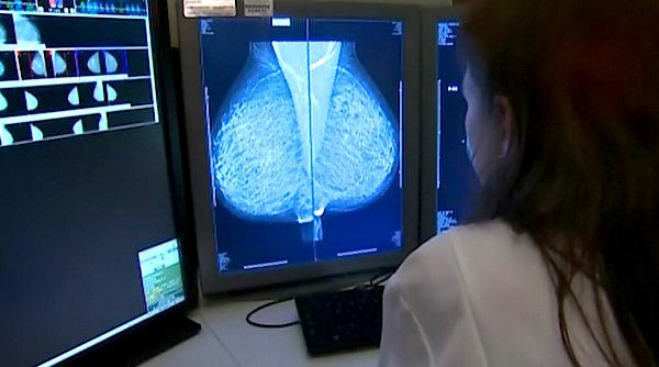 UNT cancer research, a woman review an x-ray on a computer monitor